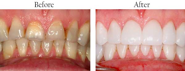 dental images 60950